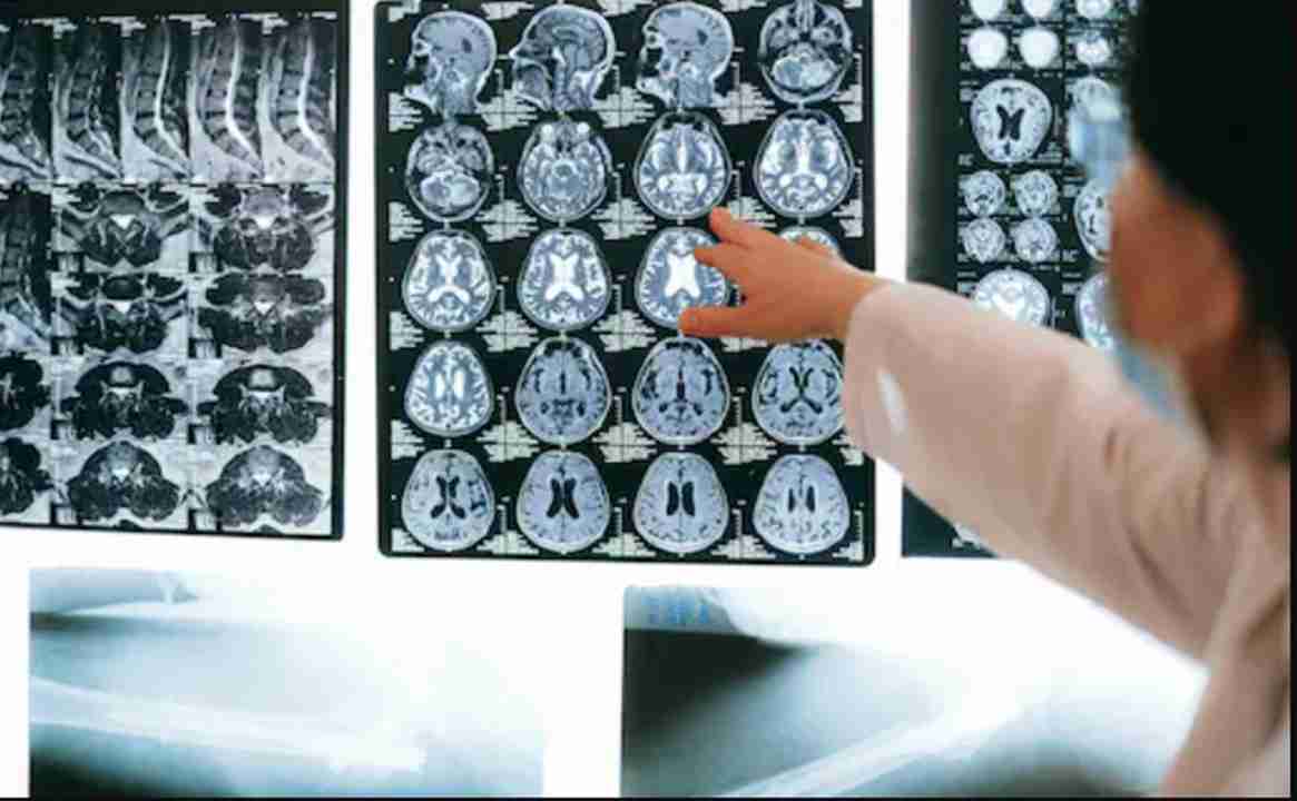 Kerala Reports 19 Deaths from 'Brain-Eating Amoeba': How It Spreads & How to Stay Safe
